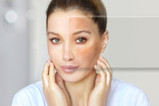 Skin Inflammation: Variants, Causes, and Smart Tips to Reduce it